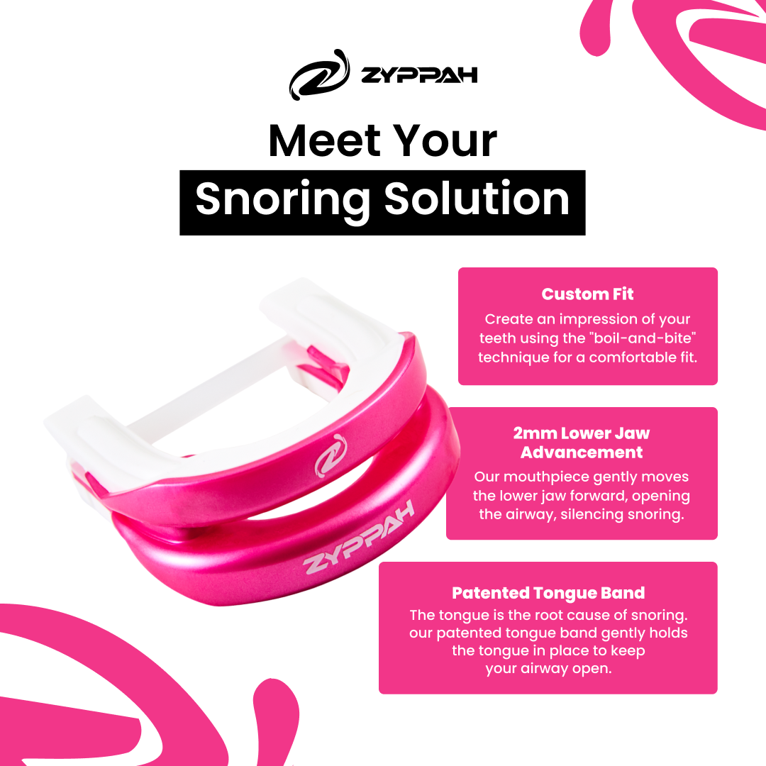 ZYPPAH Advanced Stop Snoring Device