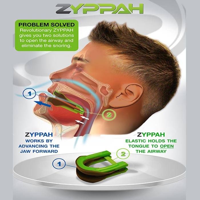 Zyppah Tech
