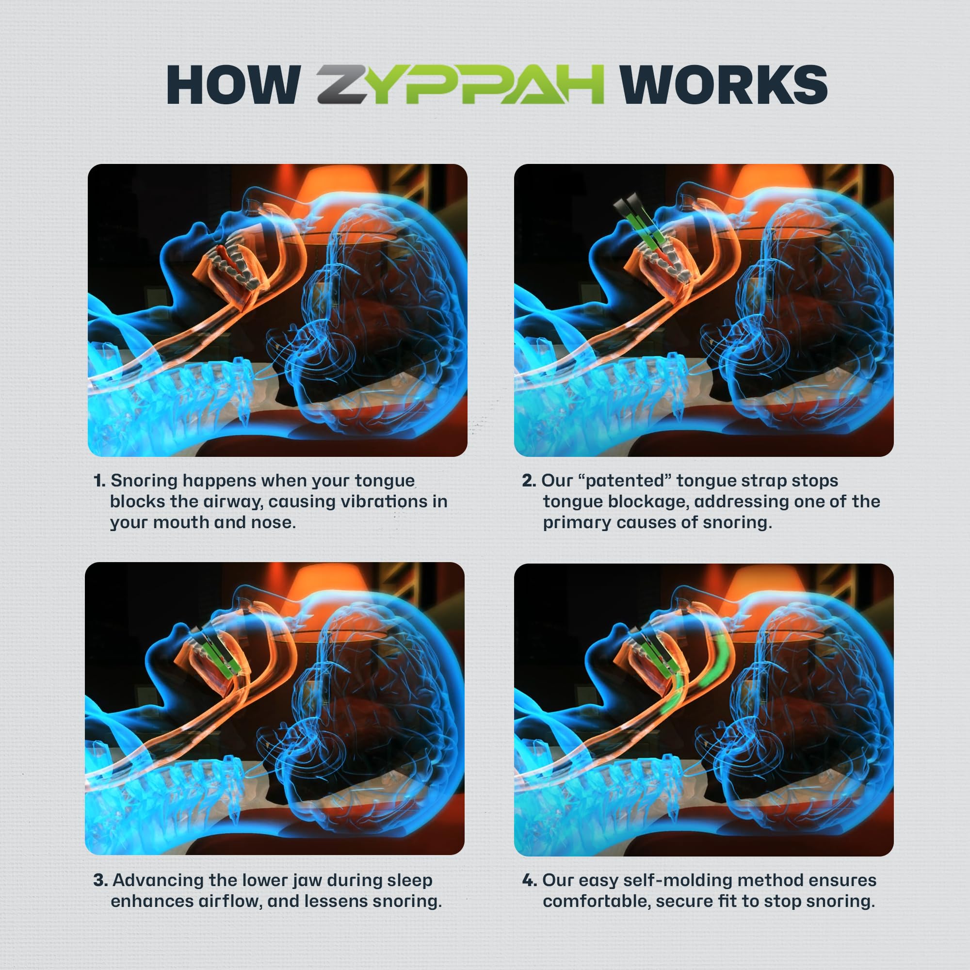 How Zyppah Works